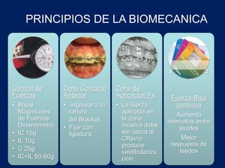 Control de
Fuerzas
• Bajas
Magnitudes
de Fuerzas
Dinanometro
• IC 15g
• IL 10g
• C 25g
• IC+IL 50-60g
Zona Contacto
Anterior
• ingresar a la
ranura
del Bracket
• Fijar con
ligadura.
Zona de
Aplicación Fx
• La fuerza
aplicada en
la zona
incisiva debe
ser cerca al
CRsino
produce
vestibulariza
cion
Invariabilidad
Fx
Fuerza Baja
continua
Aumenta
intervalos entre
ajustes
Mejor
respuesta de
tejidos
PRINCIPIOS DE LA BIOMECANICA
 