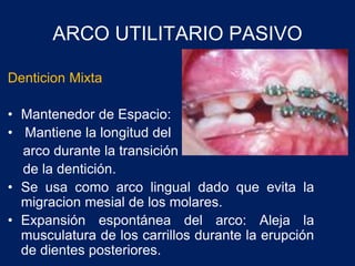 ARCO UTILITARIO PASIVO
Denticion Mixta
• Mantenedor de Espacio:
• Mantiene la longitud del
arco durante la transición
de la dentición.
• Se usa como arco lingual dado que evita la
migracion mesial de los molares.
• Expansión espontánea del arco: Aleja la
musculatura de los carrillos durante la erupción
de dientes posteriores.
 