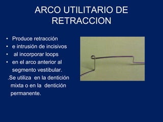 ARCO UTILITARIO DE
RETRACCION
• Produce retracción
• e intrusión de incisivos
• al incorporar loops
• en el arco anterior al
segmento vestibular.
.Se utiliza en la dentición
mixta o en la dentición
permanente.
 