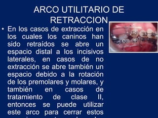 • En los casos de extracción en
los cuales los caninos han
sido retraídos se abre un
espacio distal a los incisivos
laterales, en casos de no
extracción se abre también un
espacio debido a la rotación
de los premolares y molares, y
también en casos de
tratamiento de clase II,
entonces se puede utilizar
este arco para cerrar estos
ARCO UTILITARIO DE
RETRACCION
 
