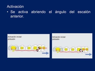 Activación
• Se activa abriendo el ángulo del escalón
anterior.
 