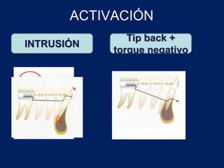 ACTIVACIÓN
INTRUSIÓN
Tip back +
torque negativo
 