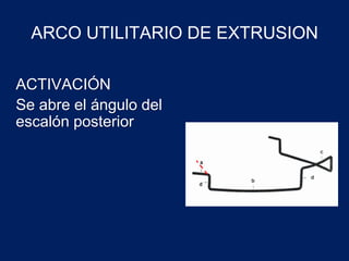 ACTIVACIÓN
Se abre el ángulo del
escalón posterior
ARCO UTILITARIO DE EXTRUSION
 