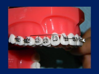 Arcos-Utilitarios.pdf