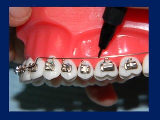 Arcos-Utilitarios.pdf