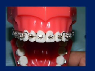 Arcos-Utilitarios.pdf