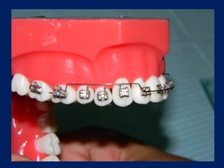 Arcos-Utilitarios.pdf