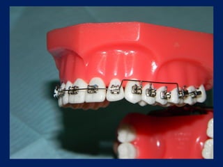 Arcos-Utilitarios.pdf