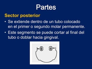 Sector posterior
• Se extiende dentro de un tubo colocado
en el primer o segundo molar permanente.
• Este segmento se puede cortar al final del
tubo o doblar hacia gingival.
 