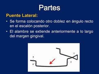 Puente Lateral:
• Se forma colocando otro doblez en ángulo recto
en el escalón posterior.
• El alambre se extiende anteriormente a lo largo
del margen gingival.
 