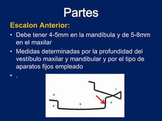 Escalon Anterior:
• Debe tener 4-5mm en la mandíbula y de 5-8mm
en el maxilar
• Medidas determinadas por la profundidad del
vestíbulo maxilar y mandibular y por el tipo de
aparatos fijos empleado
• .
 