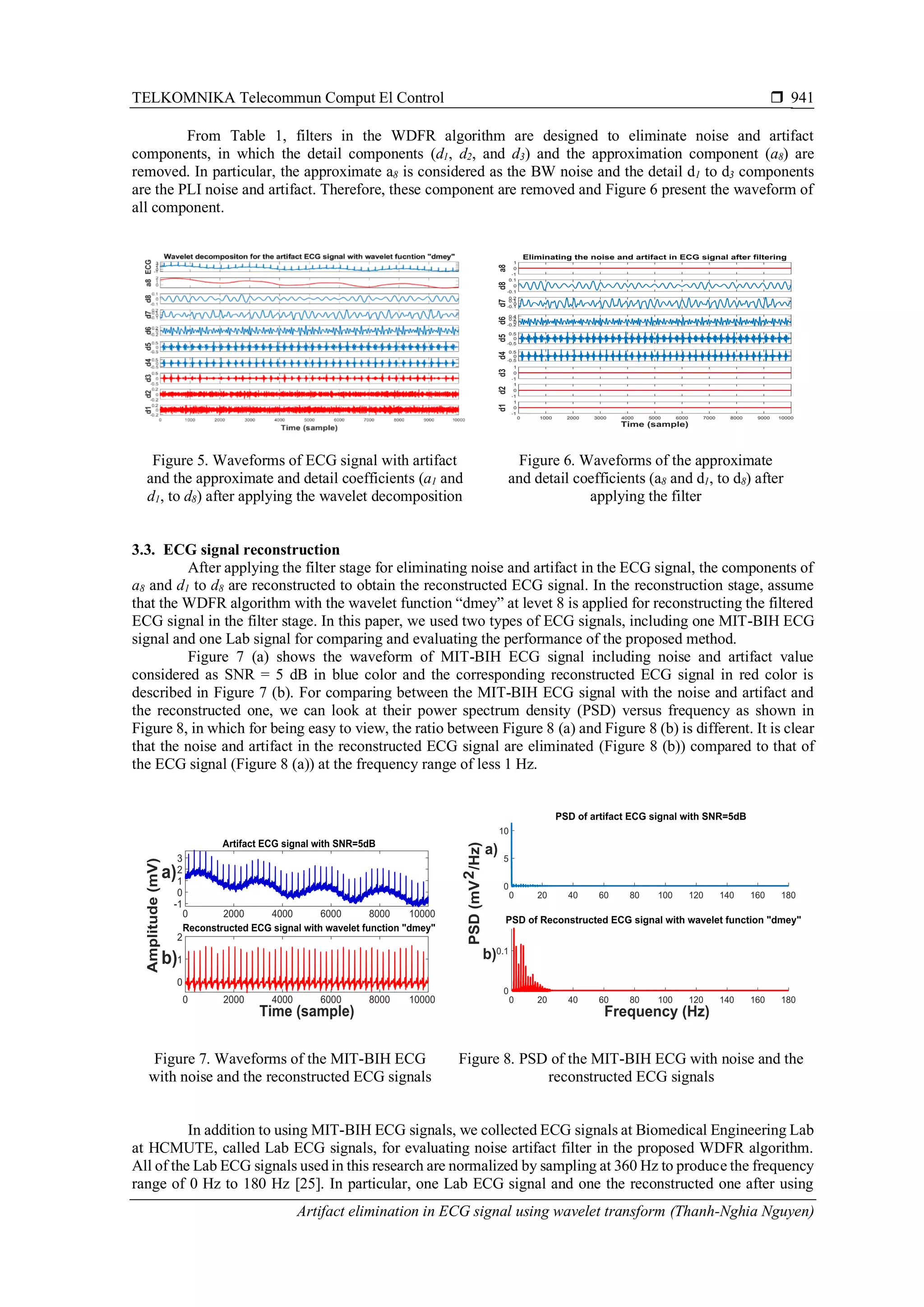 TELKOMNIKA Telecommun Comput El Control 
Artifact elimination in ECG signal using wavelet transform (Thanh-Nghia Nguyen)
941
From Table 1, filters in the WDFR algorithm are designed to eliminate noise and artifact
components, in which the detail components (d1, d2, and d3) and the approximation component (a8) are
removed. In particular, the approximate a8 is considered as the BW noise and the detail d1 to d3 components
are the PLI noise and artifact. Therefore, these component are removed and Figure 6 present the waveform of
all component.
Figure 5. Waveforms of ECG signal with artifact
and the approximate and detail coefficients (a1 and
d1, to d8) after applying the wavelet decomposition
Figure 6. Waveforms of the approximate
and detail coefficients (a8 and d1, to d8) after
applying the filter
3.3. ECG signal reconstruction
After applying the filter stage for eliminating noise and artifact in the ECG signal, the components of
a8 and d1 to d8 are reconstructed to obtain the reconstructed ECG signal. In the reconstruction stage, assume
that the WDFR algorithm with the wavelet function “dmey” at levet 8 is applied for reconstructing the filtered
ECG signal in the filter stage. In this paper, we used two types of ECG signals, including one MIT-BIH ECG
signal and one Lab signal for comparing and evaluating the performance of the proposed method.
Figure 7 (a) shows the waveform of MIT-BIH ECG signal including noise and artifact value
considered as SNR = 5 dB in blue color and the corresponding reconstructed ECG signal in red color is
described in Figure 7 (b). For comparing between the MIT-BIH ECG signal with the noise and artifact and
the reconstructed one, we can look at their power spectrum density (PSD) versus frequency as shown in
Figure 8, in which for being easy to view, the ratio between Figure 8 (a) and Figure 8 (b) is different. It is clear
that the noise and artifact in the reconstructed ECG signal are eliminated (Figure 8 (b)) compared to that of
the ECG signal (Figure 8 (a)) at the frequency range of less 1 Hz.
Figure 7. Waveforms of the MIT-BIH ECG
with noise and the reconstructed ECG signals
Figure 8. PSD of the MIT-BIH ECG with noise and the
reconstructed ECG signals
In addition to using MIT-BIH ECG signals, we collected ECG signals at Biomedical Engineering Lab
at HCMUTE, called Lab ECG signals, for evaluating noise artifact filter in the proposed WDFR algorithm.
All of the Lab ECG signals used in this research are normalized by sampling at 360 Hz to produce the frequency
range of 0 Hz to 180 Hz [25]. In particular, one Lab ECG signal and one the reconstructed one after using
-1
0
1
-0.1
0
0.1
-0.1
0
0.1
0.2
-0.2
0
0.2
0.4
-0.5
0
0.5
-0.5
0
0.5
-1
0
1
-1
0
1
0 1000 2000 3000 4000 5000 6000 7000 8000 9000 10000
-1
0
1
 