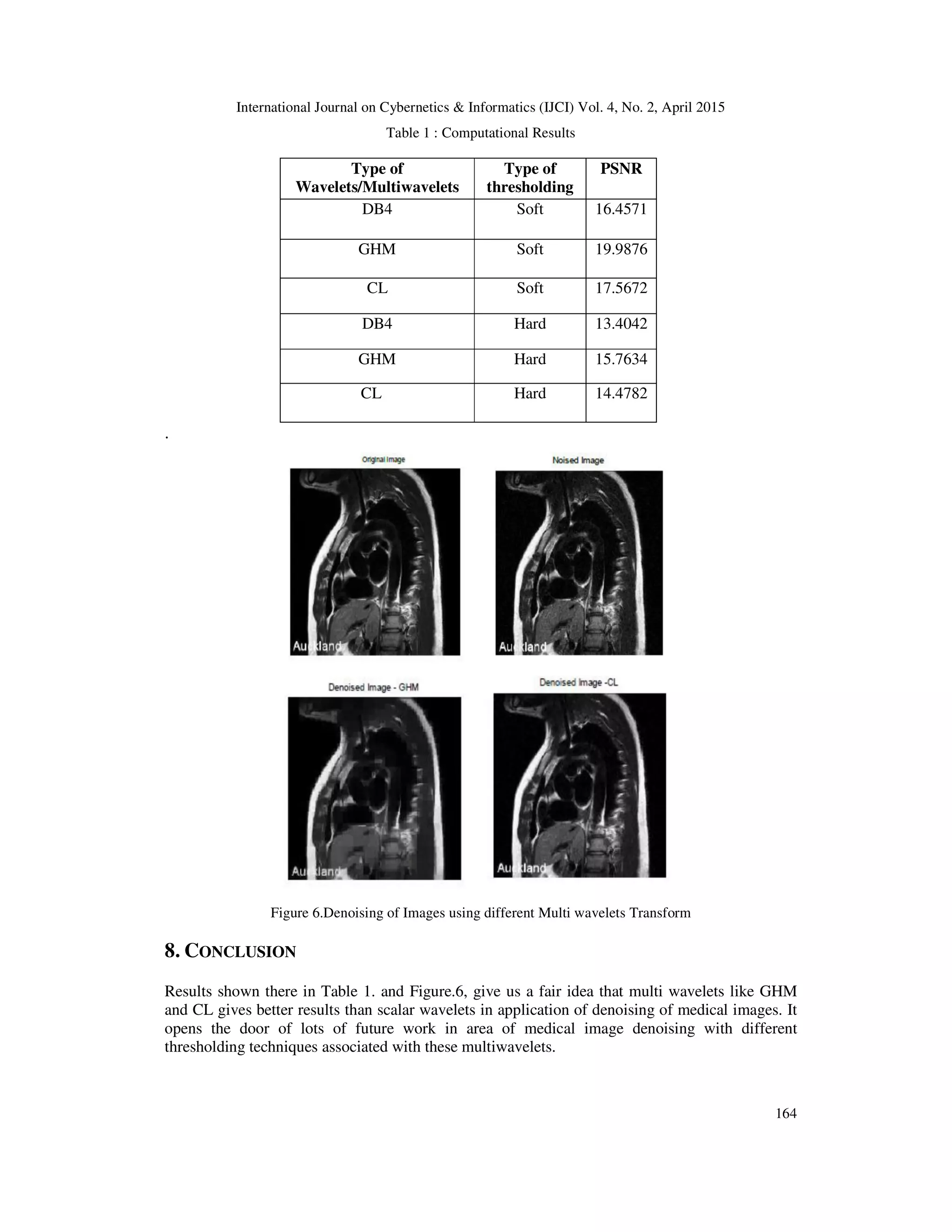 International Journal on Cybernetics & Informatics (IJCI) Vol. 4, No. 2, April 2015
164
Table 1 : Computational Results
Type of
Wavelets/Multiwavelets
Type of
thresholding
PSNR
DB4 Soft 16.4571
GHM Soft 19.9876
CL Soft 17.5672
DB4 Hard 13.4042
GHM Hard 15.7634
CL Hard 14.4782
.
Figure 6.Denoising of Images using different Multi wavelets Transform
8. CONCLUSION
Results shown there in Table 1. and Figure.6, give us a fair idea that multi wavelets like GHM
and CL gives better results than scalar wavelets in application of denoising of medical images. It
opens the door of lots of future work in area of medical image denoising with different
thresholding techniques associated with these multiwavelets.
 