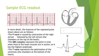 Sample ECG readout
In more detail, the features of the repeated pulse
shown above are as follows:
•The P wave is caused by contraction of the right
atrium followed by the left atrium (the
chambers at the top of the heart).
•The QRS complex represent the point in time
when most of the heart muscles are in action; so it
has the highest amplitude.
•The T wave represents the polarization of the
ventricles (the chambers at the bottom of the
heart).
 