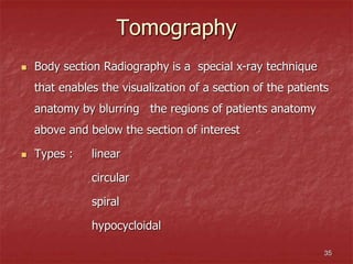 423520739-Diagnosis-and-treatment-planning.ppt