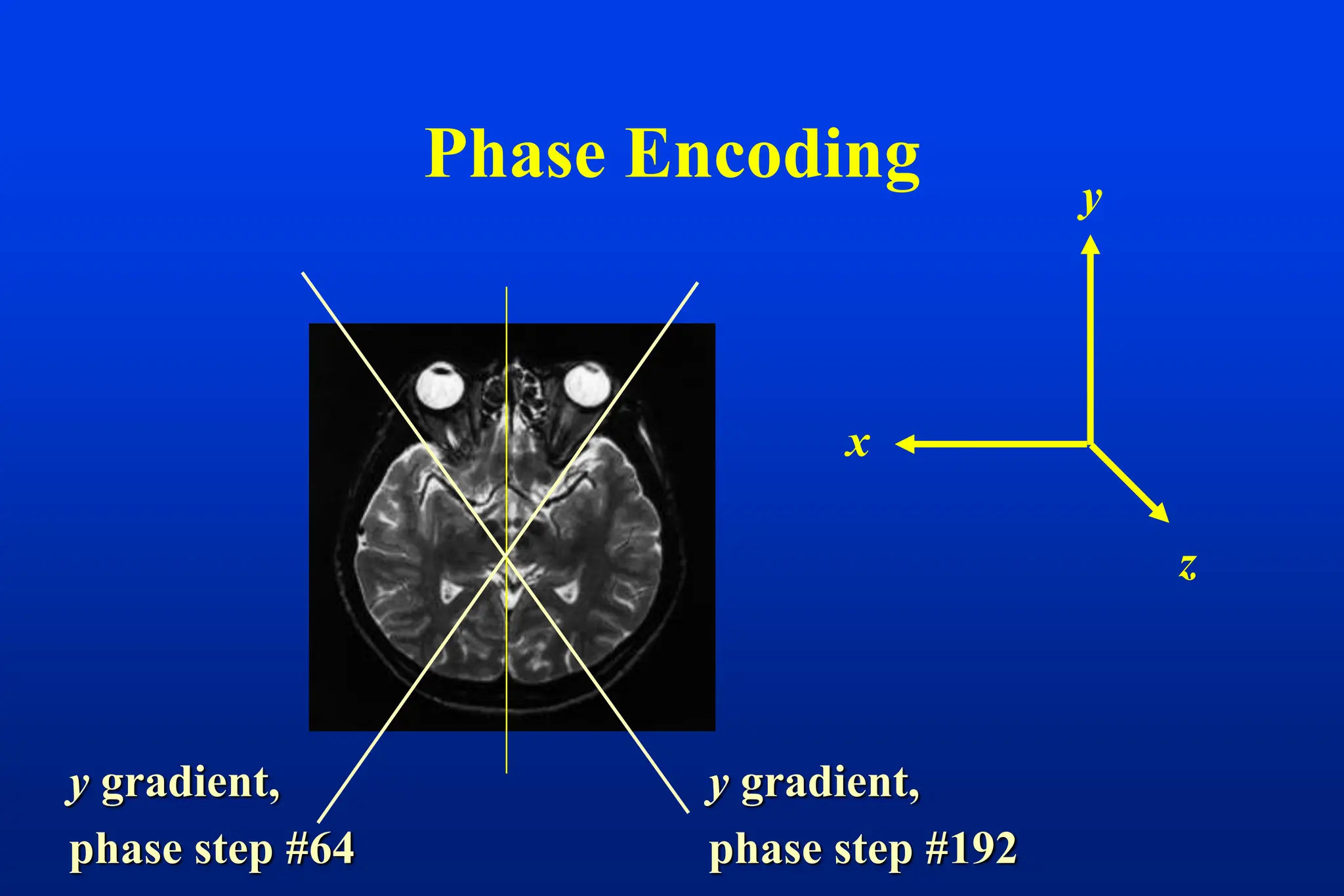 Phase Encoding
z
y
x
y gradient,
phase step #192
y gradient,
phase step #64
 