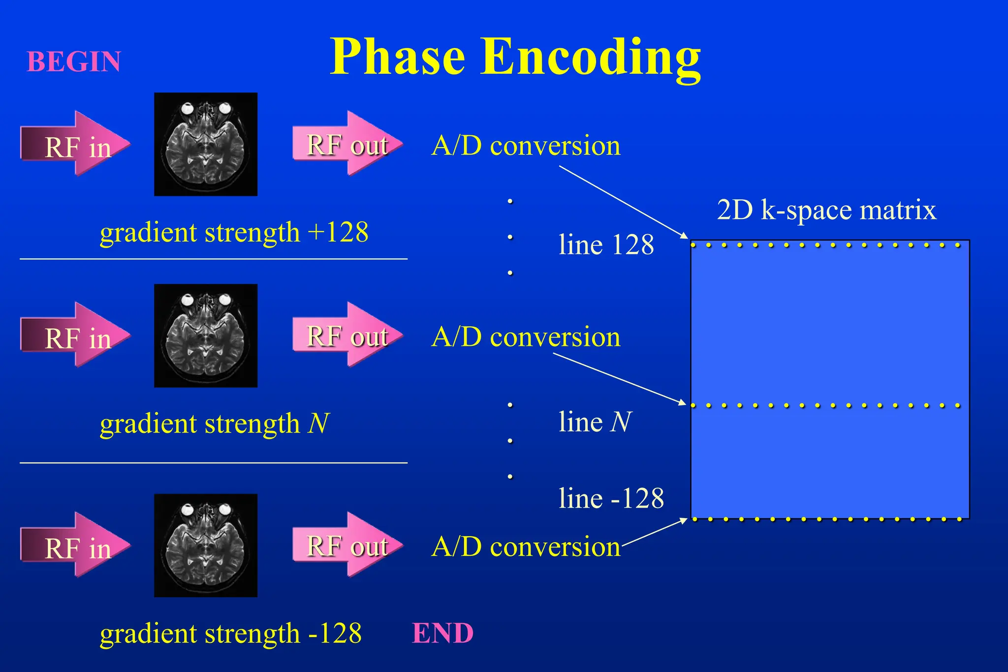 Phase Encoding
2D k-space matrix
gradient strength +128
RF in RF out A/D conversion
gradient strength N
RF in RF out A/D conversion
gradient strength -128
RF in RF out A/D conversion
                 






END
BEGIN
line 128
line N
line -128
                 
                 
 