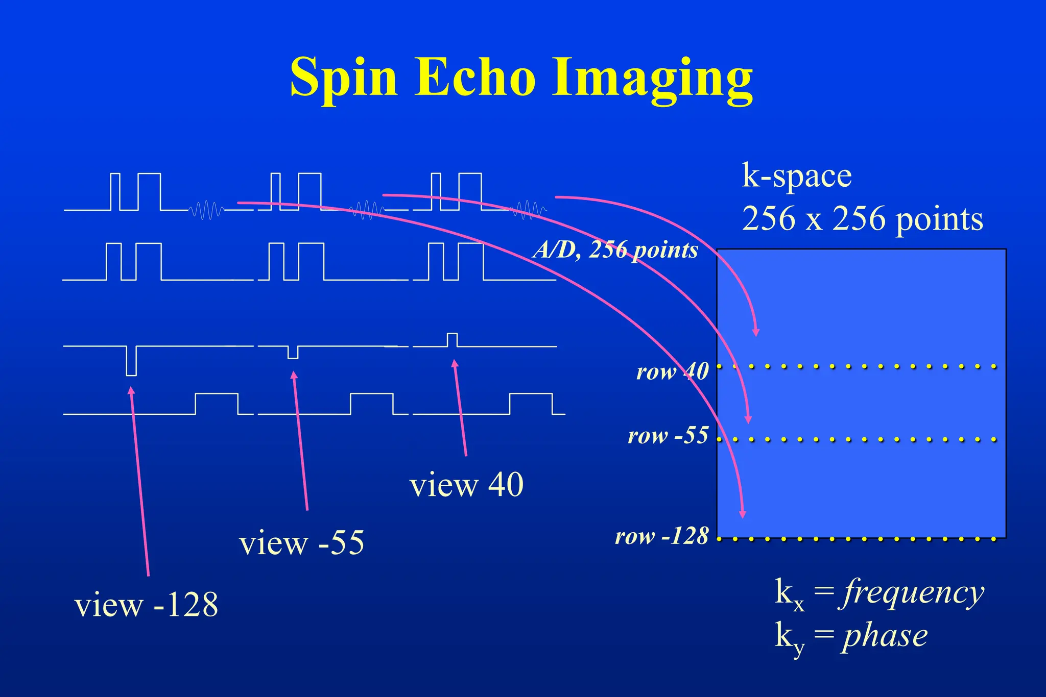 Spin Echo Imaging
view -128
view -55
view 40
                 
                 
                 
k-space
256 x 256 points
row 40
row -55
row -128
A/D, 256 points
kx = frequency
ky = phase
 