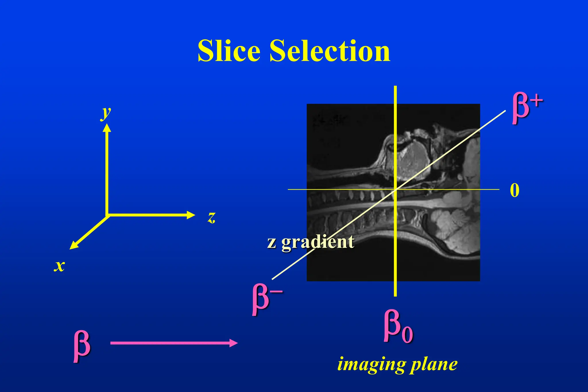 Slice Selection

z
y
x
0
imaging plane



z gradient
 