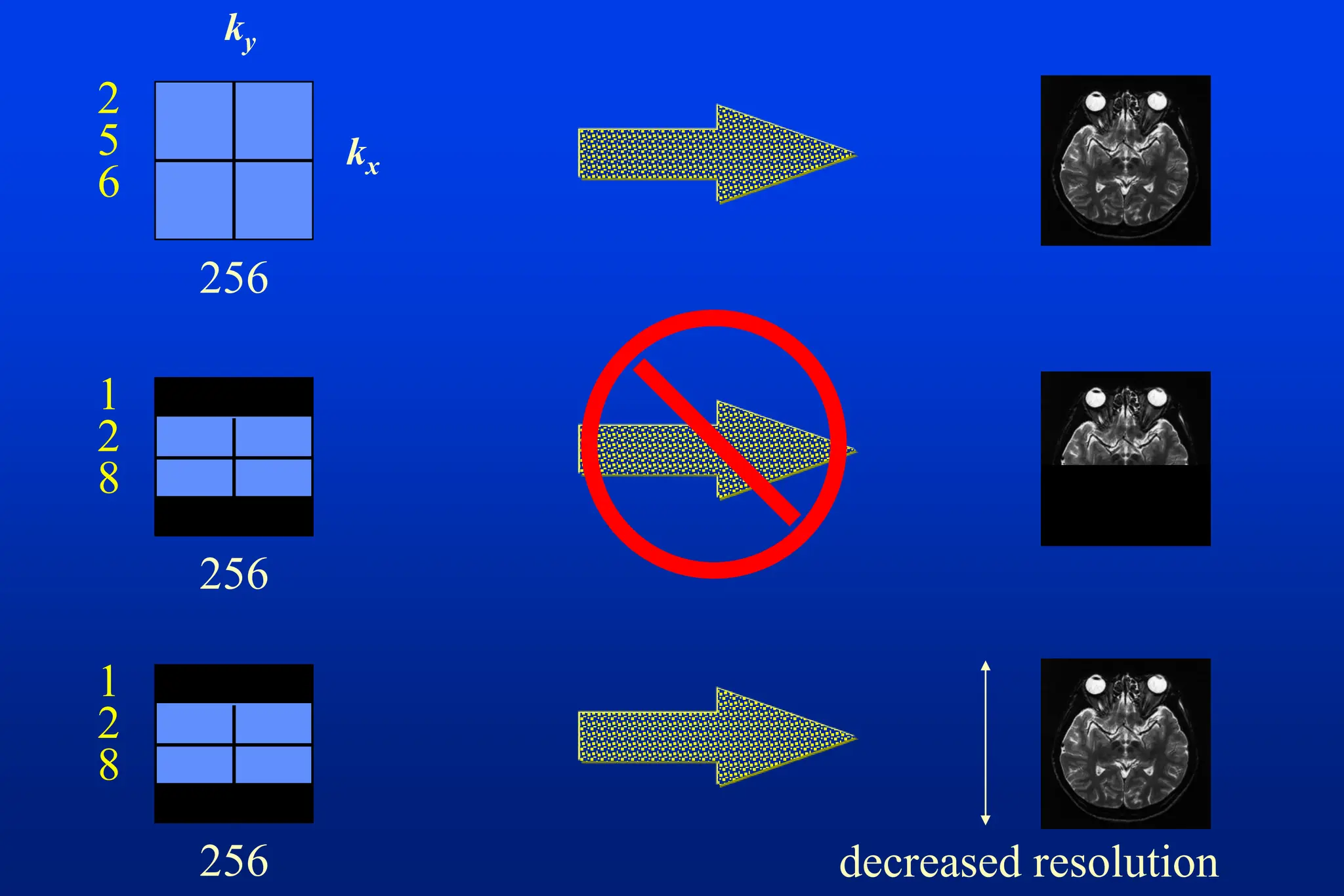 kx
ky
256
2
5
6
256
1
2
8
256
1
2
8
decreased resolution
 