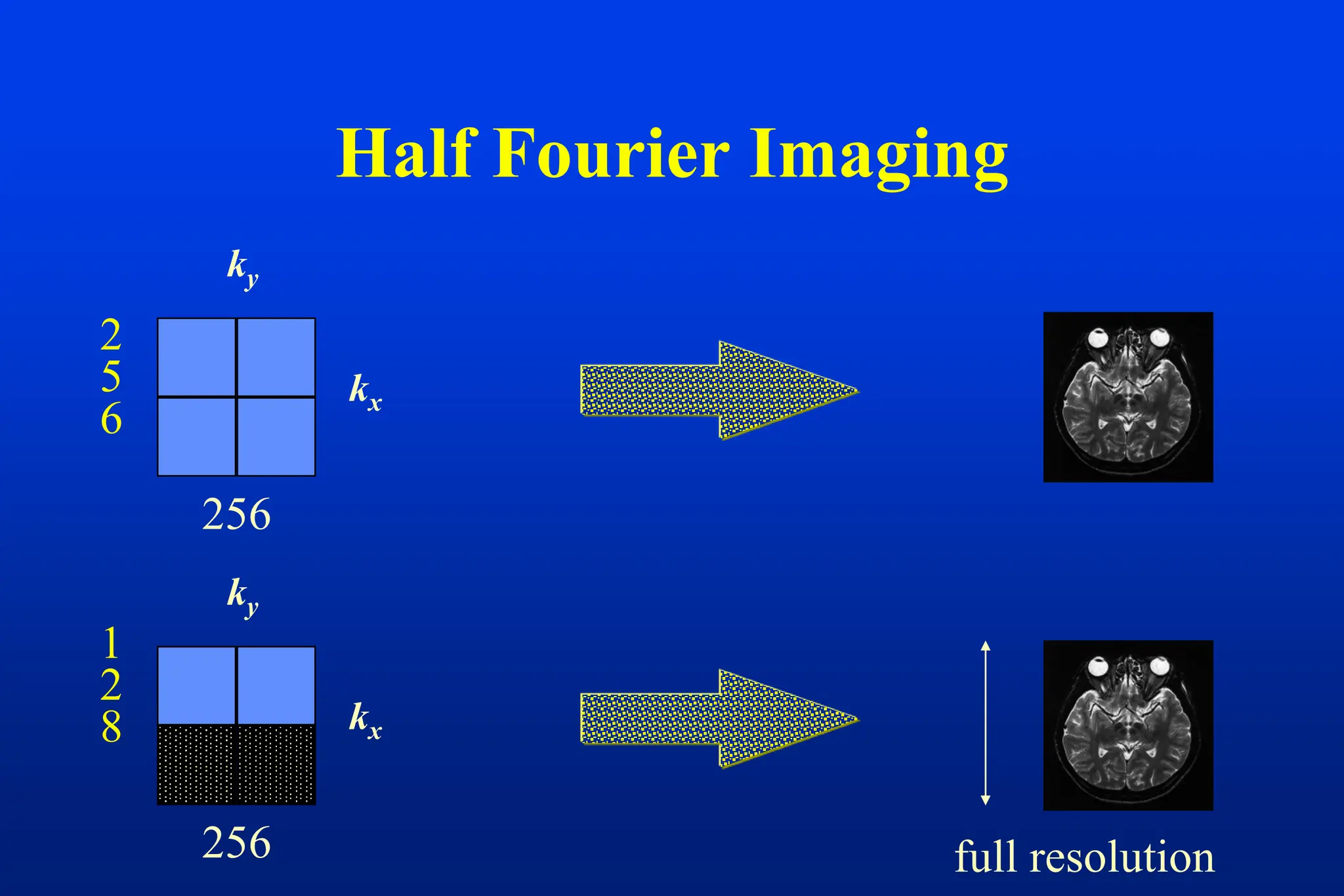 Half Fourier Imaging
kx
ky
256
2
5
6
kx
ky
256
1
2
8
full resolution
 