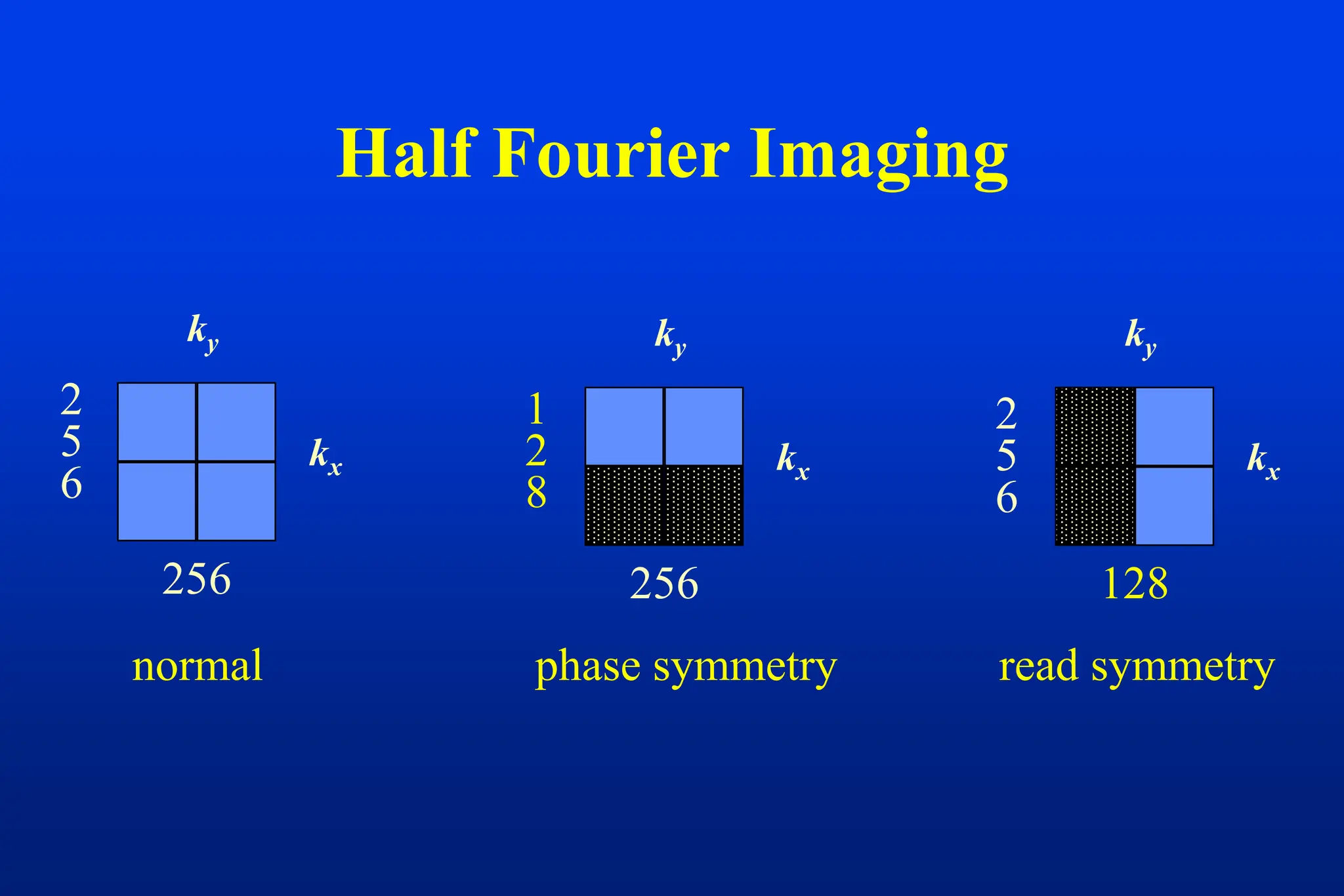 Half Fourier Imaging
kx
ky
256
2
5
6
256
kx
ky
1
2
8
normal phase symmetry
kx
ky
128
2
5
6
read symmetry
 