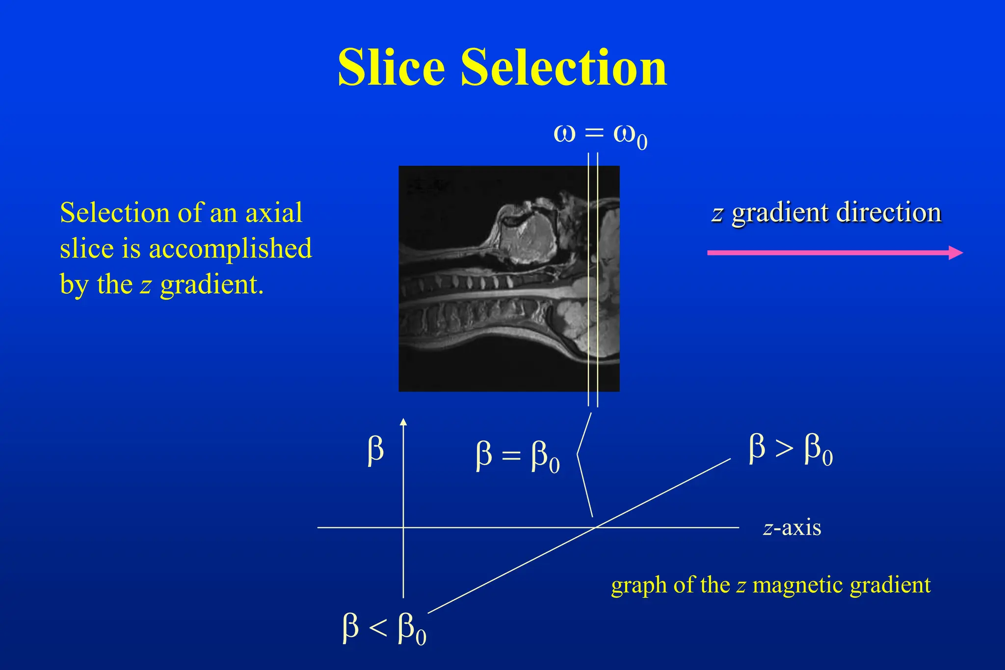Slice Selection
Selection of an axial
slice is accomplished
by the z gradient.
z gradient direction

graph of the z magnetic gradient
z-axis
 


 