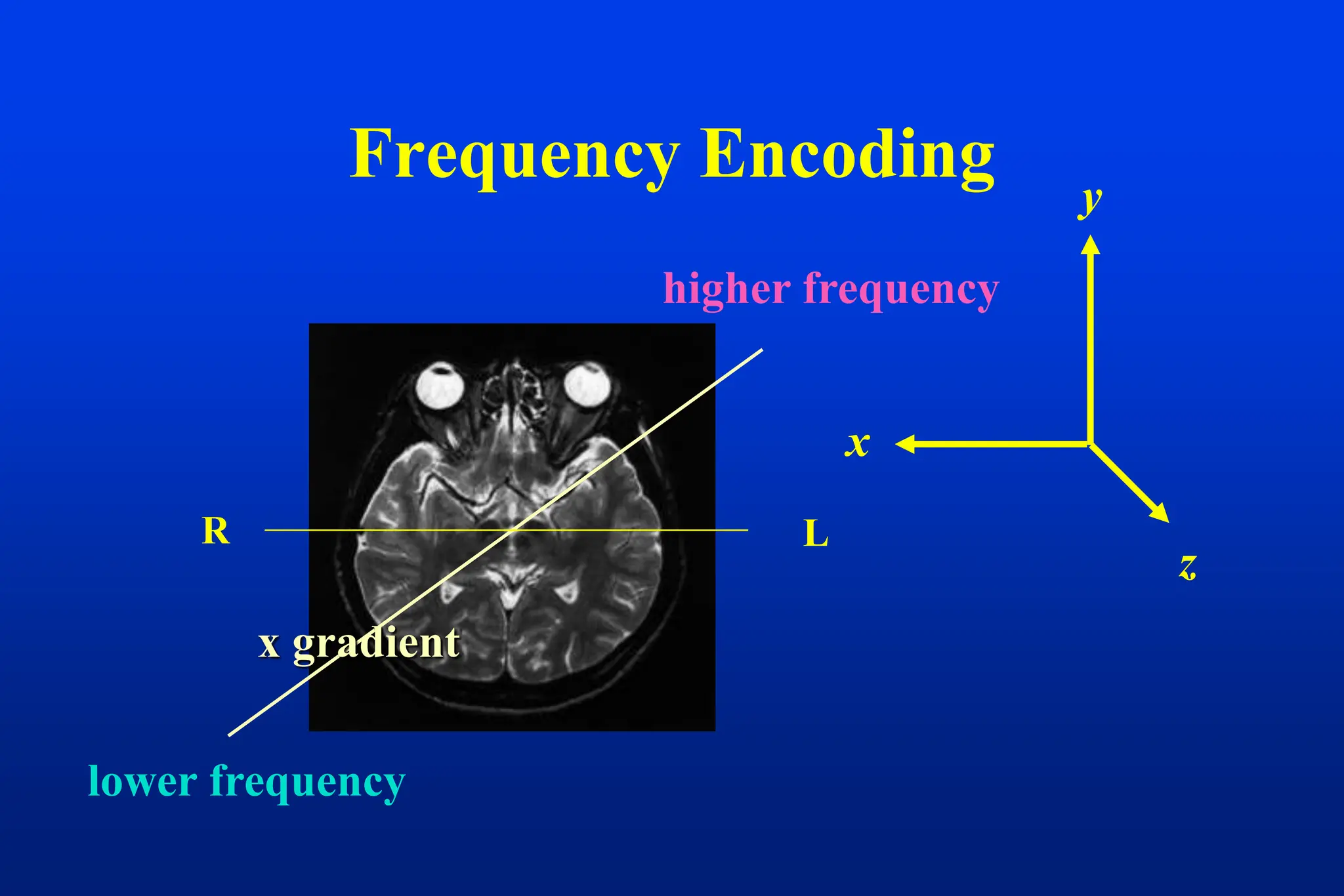 Frequency Encoding
z
y
x
x gradient
higher frequency
lower frequency
L
R
 