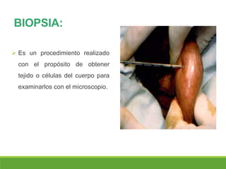 BIOPSIA:
 Es un procedimiento realizado
con el propósito de obtener
tejido o células del cuerpo para
examinarlos con el microscopio.
 