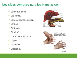Los sitios comunes para las biopsias son:
 La médula ósea.
 Los senos.
 El tracto gastrointestinal.
 El riñón.
 El hígado.
 El pulmón.
 Los nódulos linfáticos.
 La piel.
 La tiroides.
 El cerebro.
 