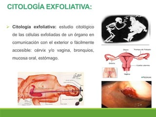 CITOLOGÍA EXFOLIATIVA:
 Citología exfoliativa: estudio citológico
de las células exfoliadas de un órgano en
comunicación con el exterior o fácilmente
accesible: cérvix y/o vagina, bronquios,
mucosa oral, estómago.
 
