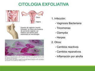 1. Infección:
- Vaginosis Bacteriana
- Tricomonas
- Clamydia
- Herpes
2. Otros:
- Cambios reactivos
- Cambios reparativos
- Inflamación por atrofia
CITOLOGIA EXFOLIATIVA
 