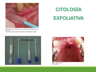 CITOLOGÍA
EXFOLIATIVA
CITO BRUSCH
 