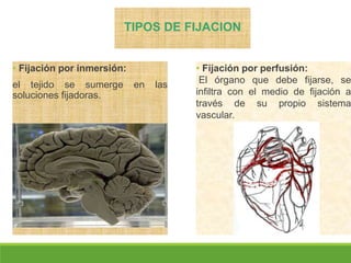 • Fijación por inmersión:
el tejido se sumerge en las
soluciones fijadoras.
• Fijación por perfusión:
El órgano que debe fijarse, se
infiltra con el medio de fijación a
través de su propio sistema
vascular.
TIPOS DE FIJACION
 