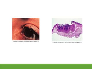 426753395-TECNICAS-HISTOLOGICAS-UPAO-2019-1-ppt.ppt