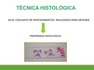 TÉCNICA HISTOLÓGICA
ES EL CONJUNTO DE PROCEDIMIENTOS REALIZADOS PARA OBTENER
PREPARADO HISTOLÓGICO
 