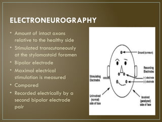 Transcutaneously Comprehensive Topodiagnostic and Electrophysiological Testing of Facial ...