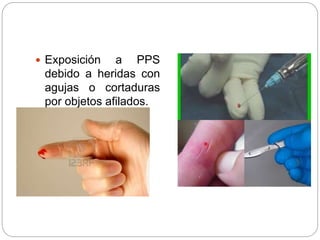  Exposición a PPS
debido a heridas con
agujas o cortaduras
por objetos afilados.
 