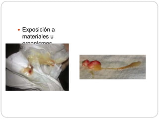 Exposición a
materiales u
organismos
infecciosos.
 