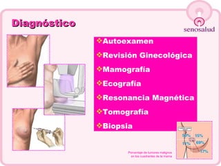 Diagnóstico Autoexamen Revisión Ginecológica Mamografía Ecografía Resonancia Magnética Tomografía Biopsia Porcentaje de tumores malignos  en los cuadrantes de la mama   