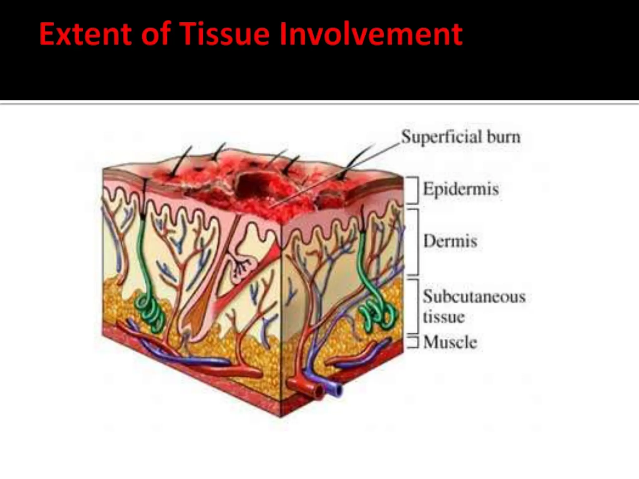 42954304112229-WOUND-assessment-1-ppt.ppt