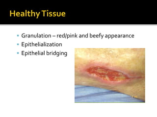 42954304112229-WOUND-assessment-1-ppt.ppt | Diseases and Conditions ...
