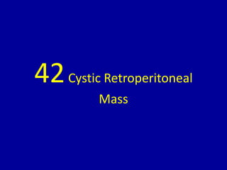 42Cystic Retroperitoneal
Mass
 