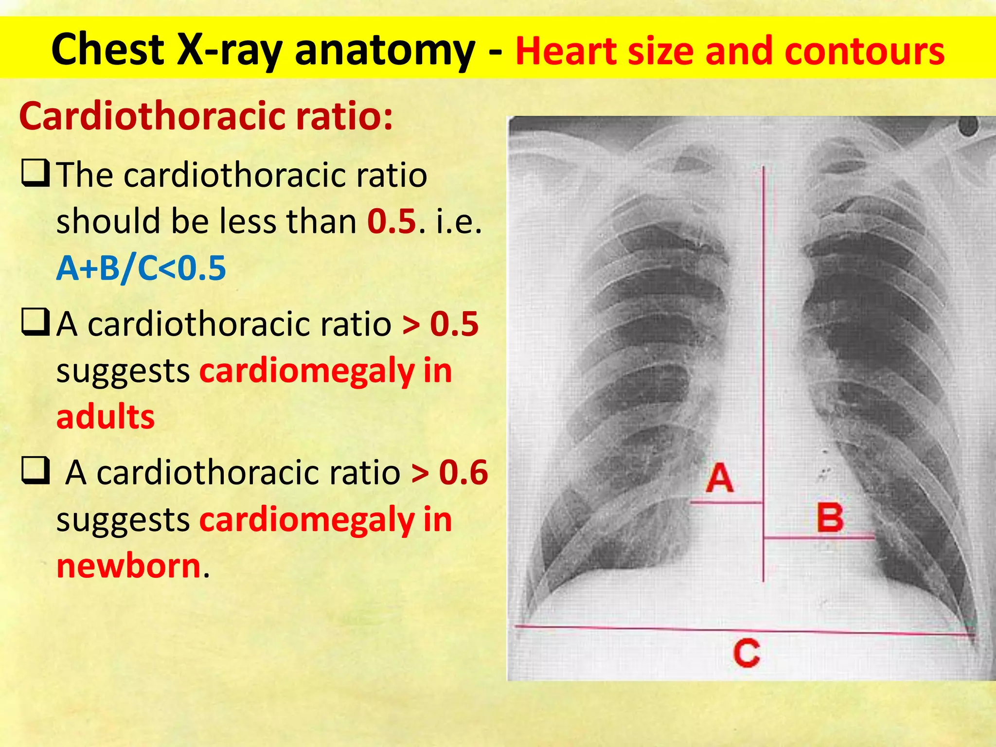Chest x ray-fundamentals | PDF