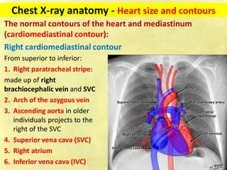 Chest x ray-fundamentals | PDF