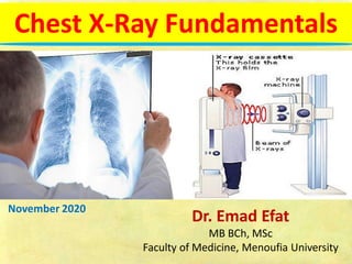 Dr. Emad Efat
MB BCh, MSc
Faculty of Medicine, Menoufia University
November 2020
Chest X-Ray Fundamentals
 