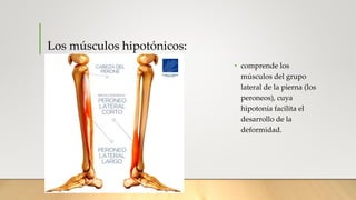 Los músculos hipotónicos:
• comprende los
músculos del grupo
lateral de la pierna (los
peroneos), cuya
hipotonía facilita ...