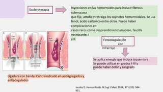 Escleroterapia
Inyecciones en las hemorroides para inducir fibrosis
submucosa
que fije, atrofie y retraiga los cojinetes hemorroidales. Se usa
fenol, ácido carbólico entre otros. Puede haber
complicaciones en
casos raros como desprendimiento mucoso, fascitis
necrosante. I
y II. Fotocoagulación
con
Infrarrojo
Se aplica energía que induce isquemia y
fibrosis.
Se puede utilizar en grados I-III y
generalmente
puede haber dolor y sangrado
Ligadura con banda: Contraindicado en antiagregados y
anticoagulados
Jacobs D. Hemorrhoids. N Engl J Med. 2014; 371 (10): 944-
951.
 