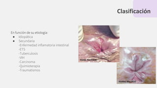 Clasificación
En función de su etiología:
● Idiopática
● Secundaria
-Enfermedad inﬂamatoria intestinal
-ETS
-Tuberculosis
-VIH
-Carcinoma
-Quimioterapia
-Traumatismos
 