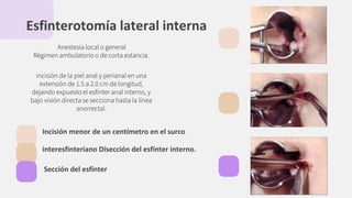 Esfinterotomía lateral interna
Anestesia local o general
Régimen ambulatorio o de corta estancia.
incisión de la piel anal y perianal en una
extensión de 1.5 a 2.0 cm de longitud,
dejando expuesto el esfínter anal interno, y
bajo visión directa se secciona hasta la línea
anorrectal.
Incisión menor de un centímetro en el surco
interesfinteriano Disección del esfínter interno.
Sección del esfínter
 